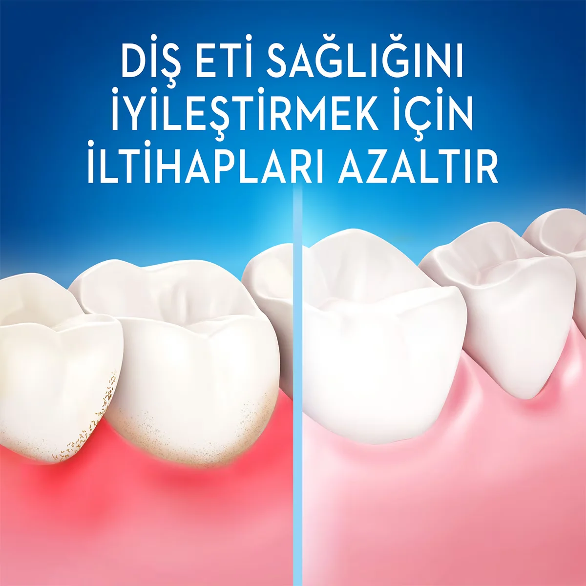 احصل على تنظيف شامل: فرشاة Oral-B متعددة الاتجاهات