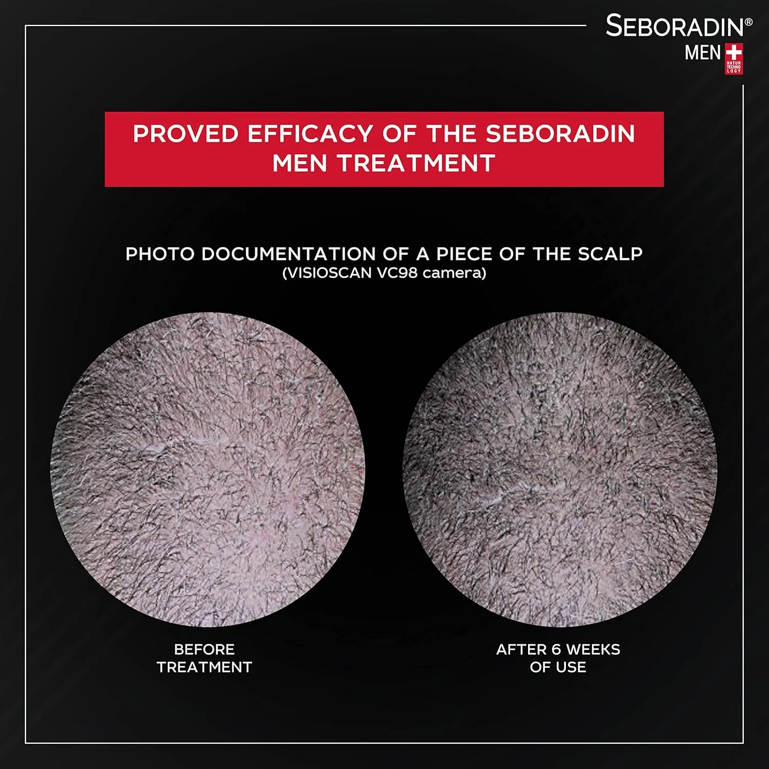 Seboradin Anti-Hair Loss Lotion for Men 200ml