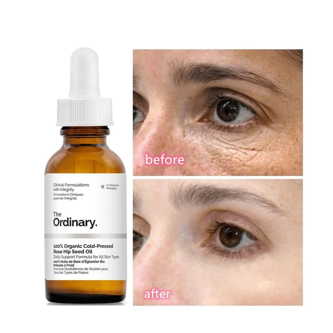 The Ordinary Caffeine Serum 5% + Egcg