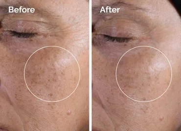 The Ordinary Glycolic Acid 7% Toning Solution Ph-3.6 240 ml