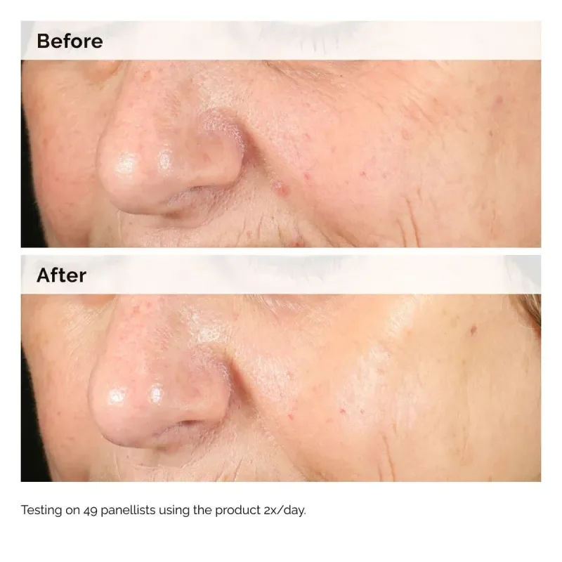 The Ordinary 2% Alpha Arbutin Skin Brightening Serum 60ml