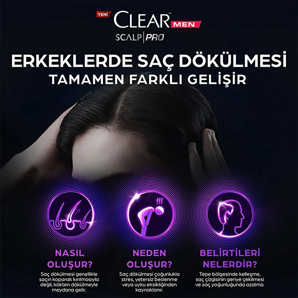 Шампунь Clear Men Scalp Pro Укрепляющий против выпадения волос и перхоти 300 мл