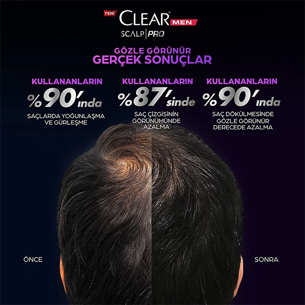Шампунь Clear Men Scalp Pro Укрепляющий против выпадения волос и перхоти 300 мл