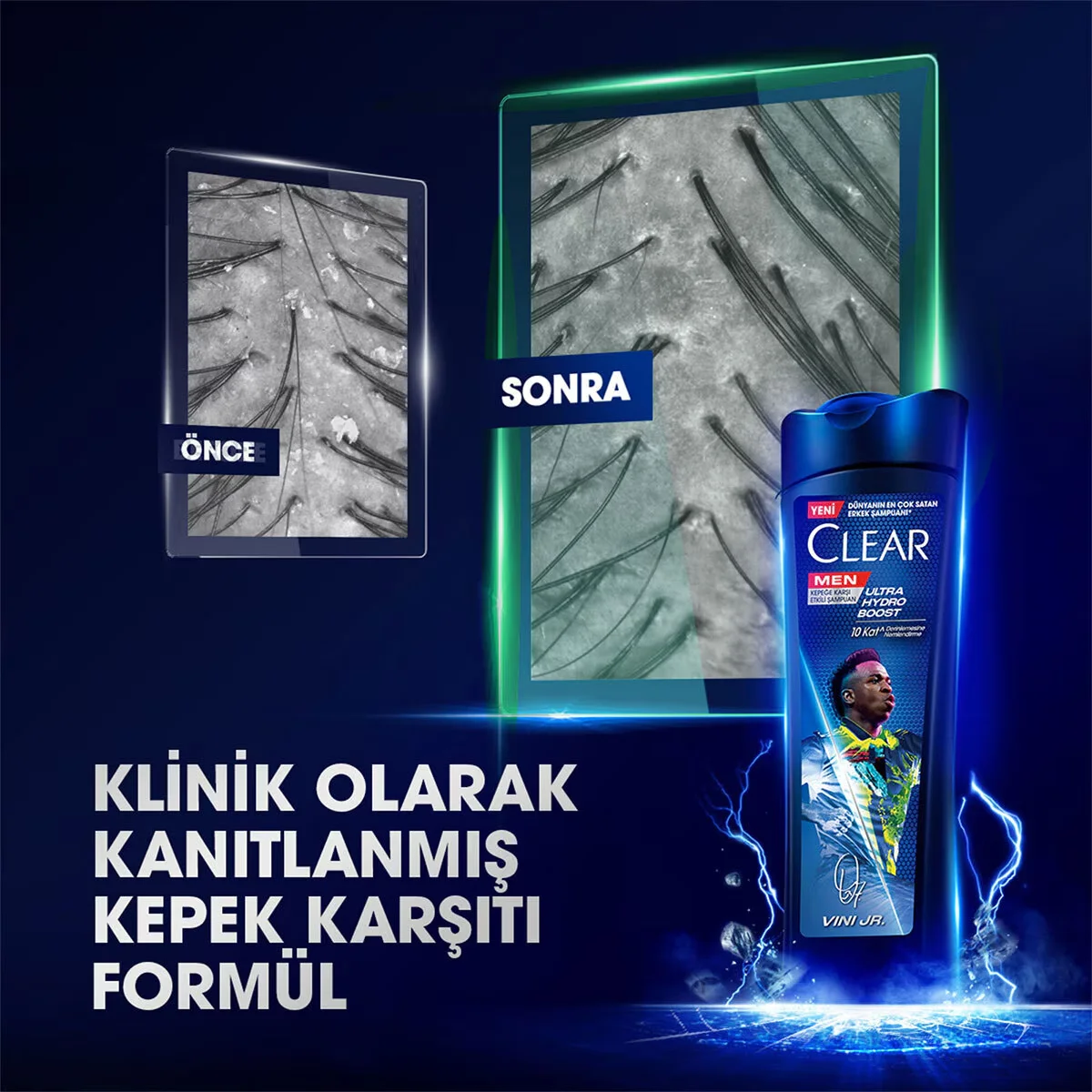 Clear Men Vinicius Junior Ultra Hydro Boost Shampoo 350ml