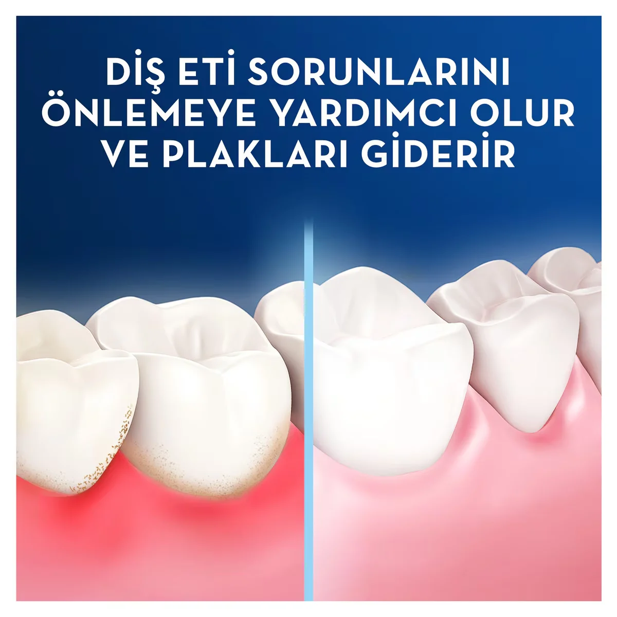 Oral-B Pro Expert gewachste Zahnseide - 25m