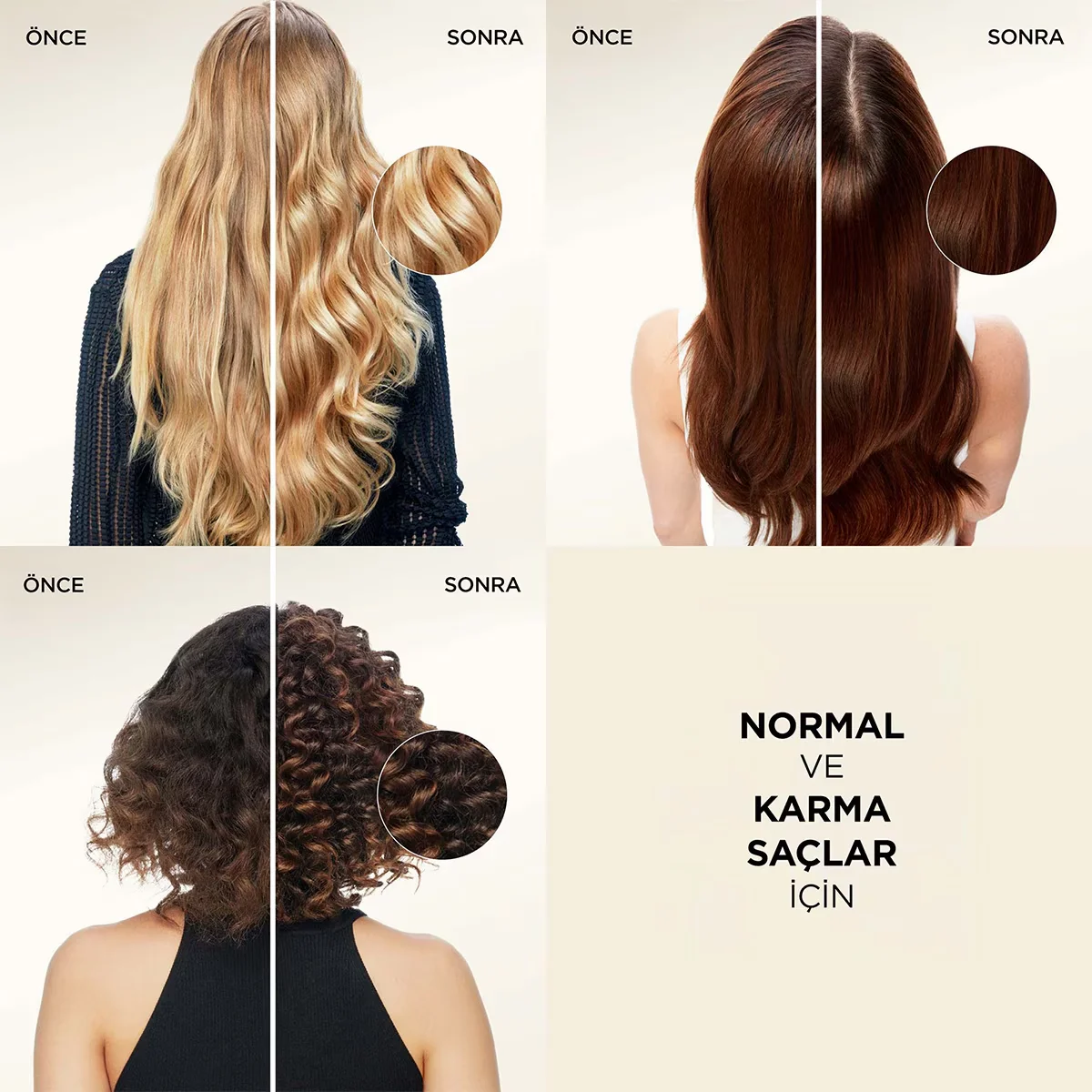 Pantene شامبو بانتين للعناية الأساسية 3 في 1 400 مل