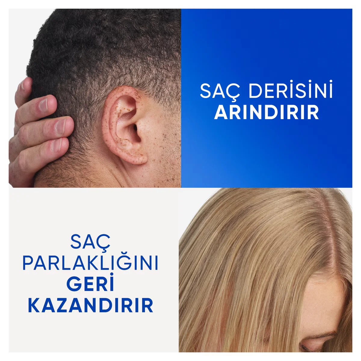Head &amp; Shoulders Apple Cider Vinegar Anti-Dandruff Shampoo 330ml