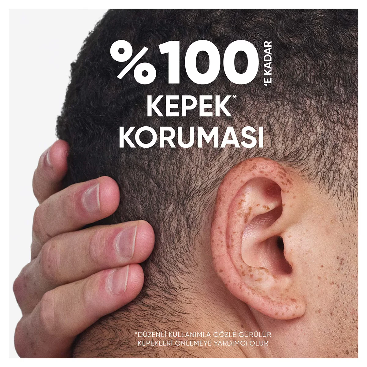 Head &amp; Shoulders شامبو هيد آند شولدرز بالليمون ٢ في ١ ٣٠٠ مل