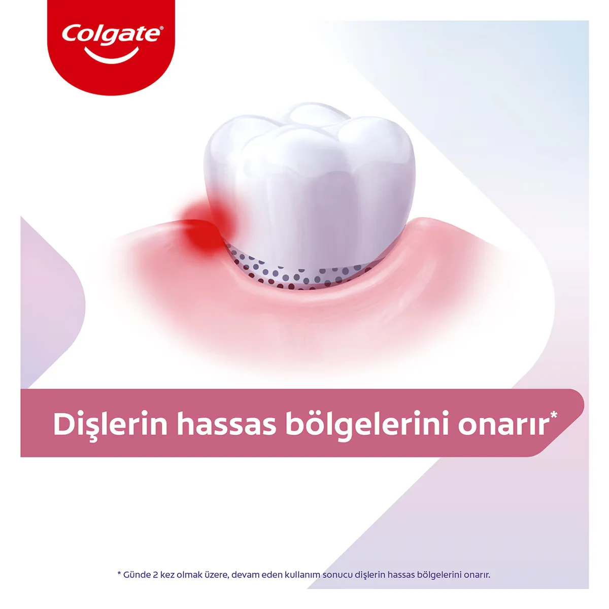 Colgate Professional Solution For Sensitive Teeth Toothpaste 75 ml.