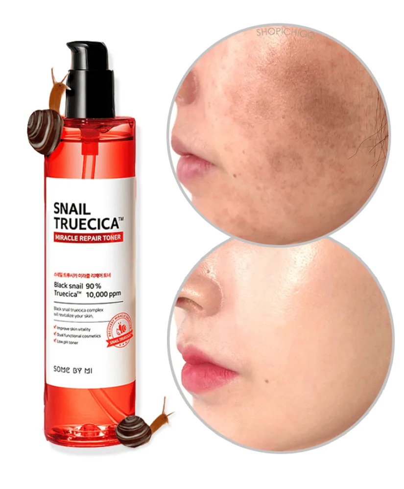 Snail Truecica Miracle Skin Repair Toner 135ml von Some By Mi
