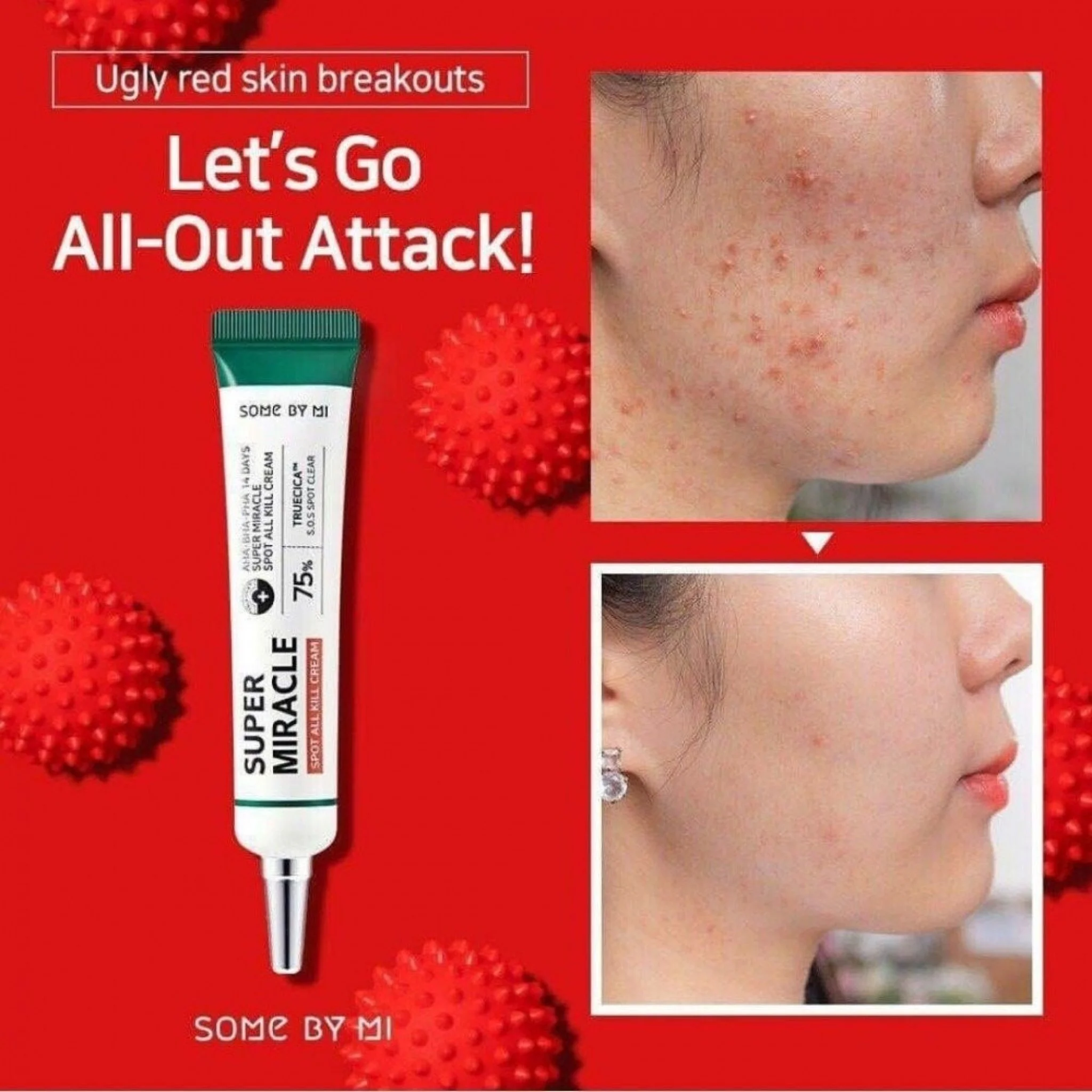 SooM Bye Me Miracle Spot Cream for Acne Treatment - 30ml