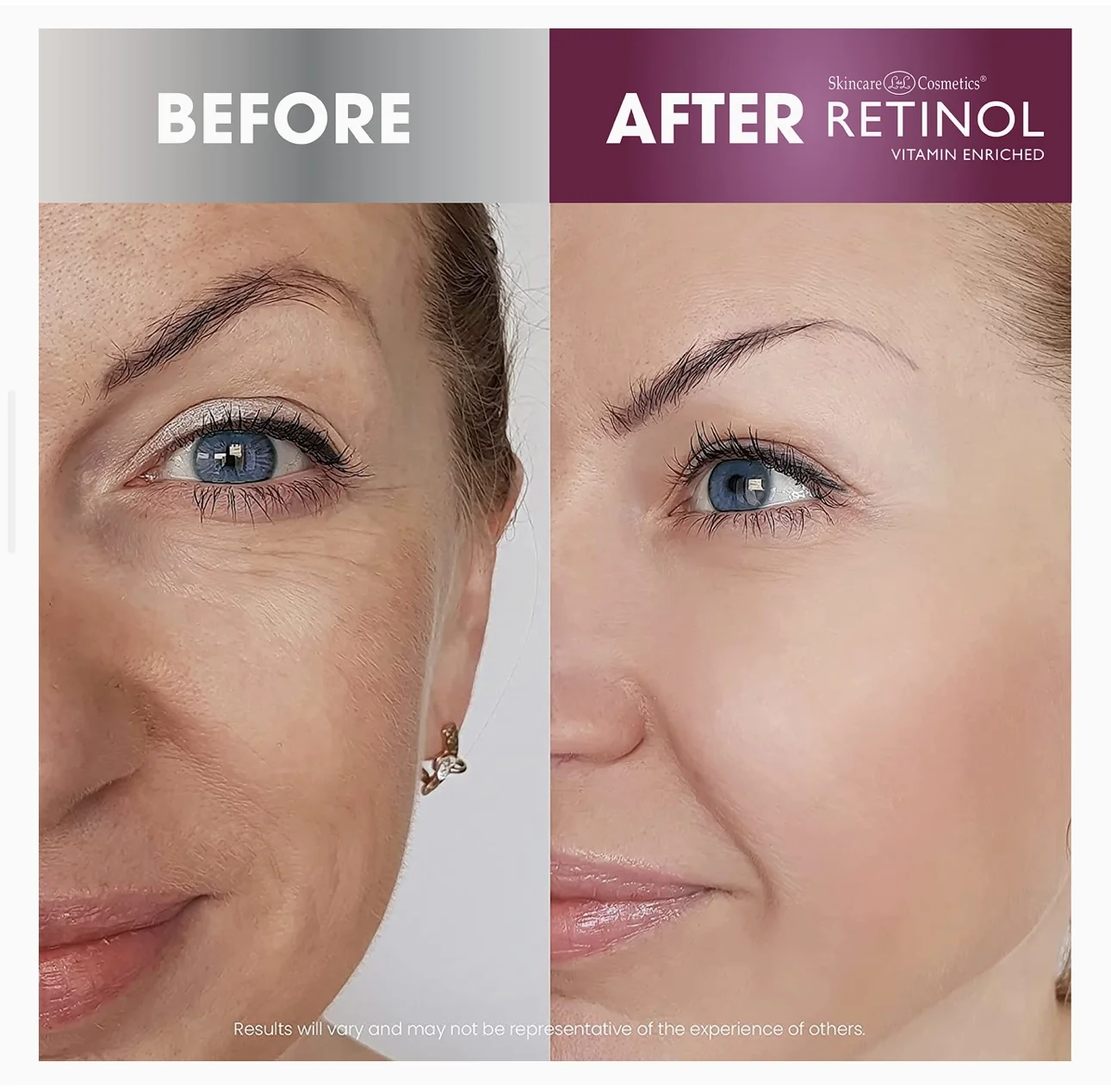Retinol Anti-Aging Hautpflege Set von SkinCare Cosmetics